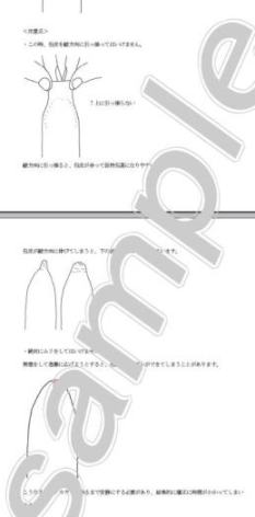 心配の秘密5