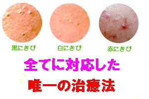 肌の秘密5